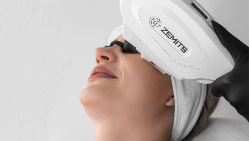 Luz Pulsada Intensa: ciência, estética e a nova era do rejuvenescimento facial