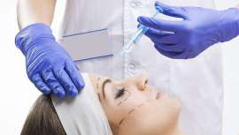 El lipofilling es una técnica que se empezó a aplicar en 1985, aunque fue el Dr. Coleman quien lo popularizó en los 90. Su evolución ha sido constante. Hoy en día es una de las técnicas más solicitadas para rejuvenecer el óvalo facial