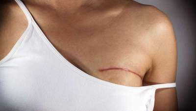 Avanzar con el paciente oncológico