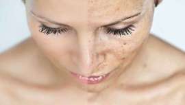 SEMAL 2026: cuando belleza y longevidad se encuentran