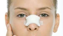 Más de 50 cirujanos a nivel internacional se han reunido en Bilbao para compartir las técnicas más novedosas en reconstrucción nasal