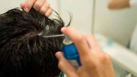 Es muy normal que entre los complementos antiseborreicos que recete un dermatólogo se encuentre este aminoácido, utilizado también en la mayoría de tratamientos contra los resfriados