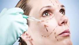 La bioplastia es un procedimiento consistente en el implante de biomateriales mediante un proceso mínimamente invasivo para aumentar de volumen o corregir determinadas partes del cuerpo