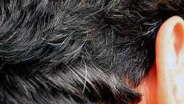 A medida que vamos envejeciendo, las canas van apareciendo en nuestro cabello como muestra del paso de tiempo. Son un síntoma de madurez que, sin embargo, fastidia a muchos por razones estéticas obvias. Pero, ¿por qué aparecen, y a veces tan pronto?