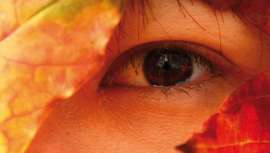 Aunque no sea una alteración grave, la cuperosis resulta bastante molesta. Es más común en mujeres que en hombres pero afecta en general a individuos con la piel clara, fina y delicada