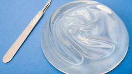 Los querellantes basaban su denuncia en la negligencia del cirujano al practicar la intervención y la inexistencia del consentimiento informado