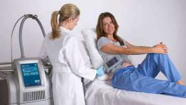 Comparativa de equipos de criolipólisis de algunas de las marcas de aparatología cuyos modelos es posible encontrar en el mercado español. Comparativa de características técnicas.