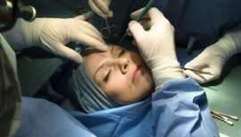 La razón de este descenso no se debe a la falta de ganas de los usuarios de este tipo de cirugía, sino a la falta de crédito