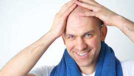 Podemos definir la alopecia como un cese o deficiencia de la regeneración del cabello. Hasta ahora se había actuado sobre el efecto. El presente y el futuro es el tratamiento de la causa