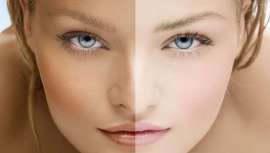 Este producto natural con función blanqueadora es muy utilizado en Asia. Al inhibir la producción de melanina, reduce la intensidad de las manchas y homogeneiza la tez