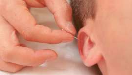 Este método consiste en estimular los puntos reflejos que hay en la oreja para activar el sistema nervioso, produciendo una respuesta por la que el organismo utilizará sus propios recursos para recuperar el equilibrio y la salud