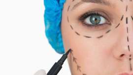 Esta técnica no puede parar el proceso de envejecimiento pero sí
mejorar los signos de descolgamiento más visibles