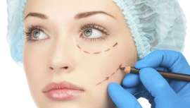 Utilizando hilos tensores bio-reabsorbibles, con esta técnica clínica se consigue tensar diferentes zonas tanto faciales como corporales de manera ambulatoria, indolora y rápida, pudiéndose realizar un lifting facial en 30 minutos