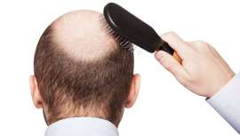Científicos estadounidenses han descubierto un método para tratar la calvicie sin trasplante de cabello. Se trata de un mecanismo que hace crecer nuevos folículos de pelo