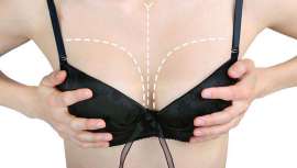 Una nueva ola de aplicaciones para smartphones permite a los usuarios ver los resultados de la cirugía plástica, incluso antes de pasar por el quirófano