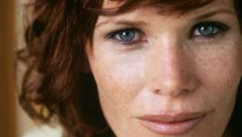 Un estudio realizado a un grupo de islandeses explica una vía molecular compleja que puede contribuir también a conocimientos sobre enfermedades de la piel, como el melanoma