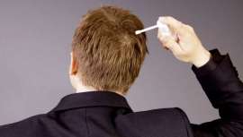 La ciencia de la salud y de la estética se unen en un descubrimiento que puede revolucionar los tratamientos contra la alopecia