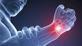 Esta enfermedad provoca dolor crónico y limitación de movimiento de la mano, lo que puede suponer un gran problema para un estilista e incluso obligarle a abandonar la profesión