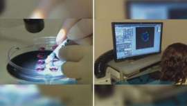 La terapia funcionó a los cuatro y cinco meses de empezar el tratamiento, aunque de momento son muy pocos casos y se necesitarán ensayos clínimos más amplios