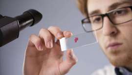 Los factores de crecimiento son unas proteínas naturales que inducen la proliferación celular. En concreto, el Factor de Crecimiento Epidérmico (FCE) aporta beneficios regeneradores y antiaging en tratamientos y cosméticos especializados