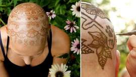 En el año 2011, un grupo de activistas y tatuadoras de Toronto (Canadá), encabezado por Frances Darwin, creó Henna Heals, un movimiento que brinda su apoyo a mujeres que han perdido el pelo por culpa del cáncer o cualquier otra patología