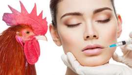 Hoy en día, el ácido hialurónico es muy popular como relleno facial, a través de inyecciones subcutáneas. Se sabe mucho acerca de sus propiedades hidratantes y rejuvenecedoras, aunque no tanto acerca de su presencia en el resto de seres vivos