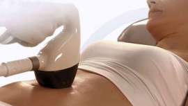 Desde el pasado 12 de abril, la empresa Syneron Candela, filial de Syneron Medical, fabrica el modelo VelaShape III. Un aparato que combate celulitis, grasa localizada y flacidez de forma no invasiva