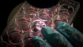 Investigadores estadounidenses han descubierto que las células madre pluripotentes humanas (iPS) pueden generar cabello de nuevo. La investigación representa una mejora notable sobre las alternativas actuales, entre las que se incluye el trasplante