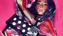 El pasado 25 de junio se celebró el Día Internacional del Vitíligo, una enfermedad cutánea desconocida para muchos. Con un tratamiento prolongado pero sencillo, los pacientes consiguen mejorías notables