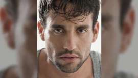 La Técnica FUE permite extraer individualmente los folículos pilosos de la zona donante a la zona donde se quiere que crezca el pelo