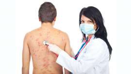La Academia Española de Dermatología y Venerología y la Asociación de Afectados de Urticaria Crónica preparan actividades para concienciar sobre esta enfermedad que afecta a más de 300.000 españoles