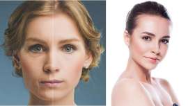 Este protocolo, apto para cualquier piel, ofrece resultados inmediatos en la zona tratada. Golden, desarrollado en el Instituto de Belleza de Maribel Yébenes, promete suprimir los efectos del paso del tiempo durante siete años en una sesión