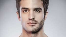 La barba empieza a ser una obsesión para aquellos que quieren cambiar de look adaptándose a las nuevas tendencias. Los implantes de barba desembarcan en nuestro país para regocijo de los centros donde se realizan