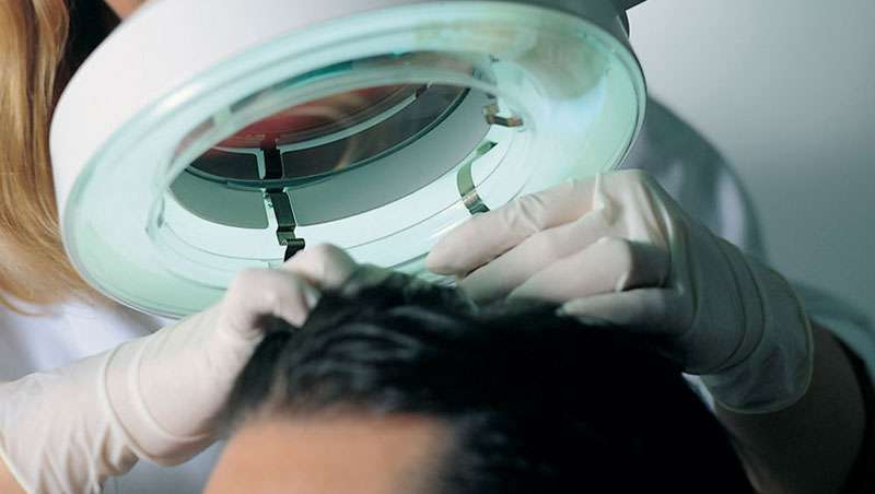 dermatologa analizando cuero cabelludo hombre