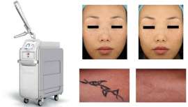 El amor, las bromas pesadas o los desafíos son las peores motivaciones para inocular tinta en la piel, según revela el último estudio internacional realizado por Syneron Candela sobre los famosos mejor tatuados