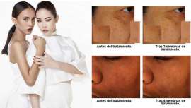 Sederma, especializada en ingredientes activos para la industria cosmética, anuncia el lanzamiento de Mediatone. Este activo actúa como mediador del tono de la piel en pos de un rostro más claro y uniforme