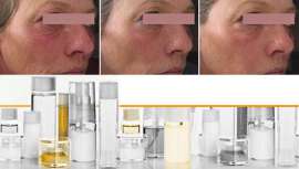 Sederma acaba de presentar Renovage, un ingrediente antiaging de alta tecnología que actúa sobre todos los factores del envejecimiento dérmico: superficie, profundidad y tiempo