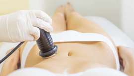 Las ondas de choque como método para remodelar la figura