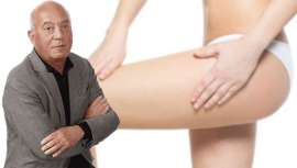 El cirujano plástico Antonio Tapia nos da las claves sobre esta novedad, demandada por el 10% de las mujeres, entre ellas celebrities, para verse mejor gracias al lifting de muslos