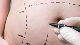 El doctor Francisco Menéndez-Graíño, presidente de la AECEP, considera que este incremento se debe a las reacciones de los excesos navideños, los días de vacaciones y el clima primaveral