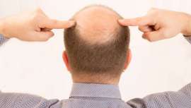 Por primera vez, en Japón han producido piel sintética con las mismas funciones que la real. Este tejido artificial suda y genera cabello, entre otras características. Un gran avance contra la alopecia y la calvicie