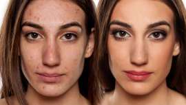 Una gran parte de la utilidad del maquillaje está destinada a fines de belleza, pero hay muchos tipos de maquillaje, como el terapéutico, que van más allá de la estética para hacer sentir mejor a muchas personas