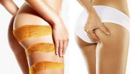 El cosmetólogo y director del Centro de Belleza Santum, Daniel Marín, propone dos técnicas que, combinadas, consiguen remodelar la silueta