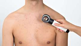 La Fundación Piel Sana de la AEDV convoca dos ayudas para proyectos de desarrollo o de intervención sanitaria que se presenten antes del 16 de mayo