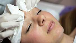 El Instituto Maribel Yébenes presenta este tratamiento avalado por la FDA. Elimina las marcas de acné hasta en un 90% gracias a su combinación de nanofrecuencia microfragmentada más oxigenoterapia inyectada