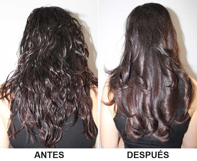 antes y despues de un tratamiento de Enzimoterapia