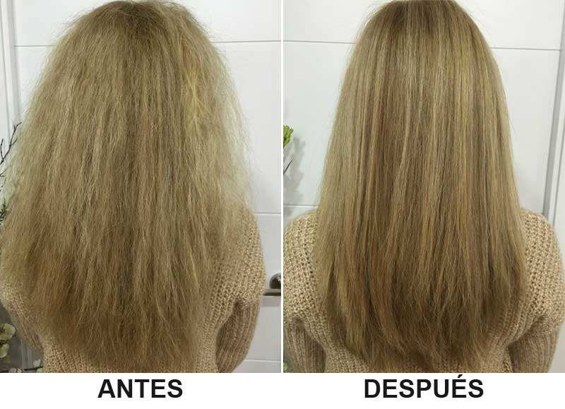 Antes y despues de un tratamiento de enzimoplastia capilar