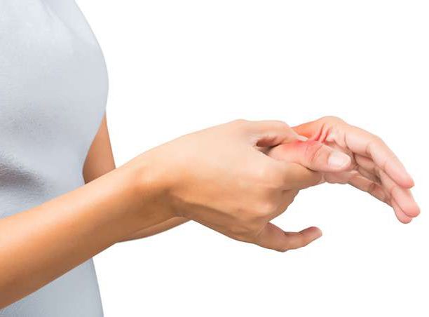 Rizartrosis o artrosis del pulgar, enfermedad del peluquero