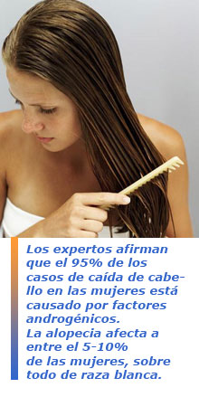 alopecia femenina