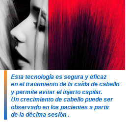 Led Up: luz led para acelerar el crecimiento de los cabellos